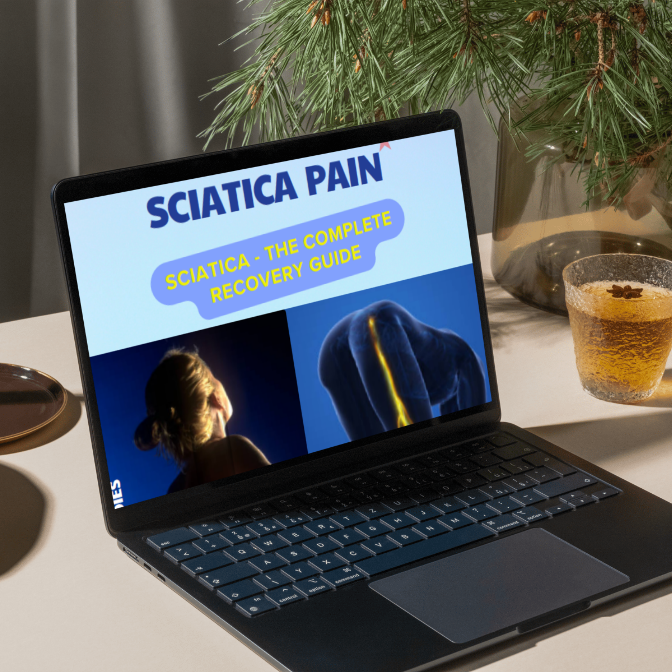 Sciatica - The Complete Recovery Guide